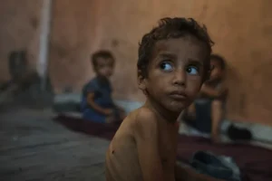 ما يزيد عن 80 طفل توفي إثر التجويع والحصار في غزة